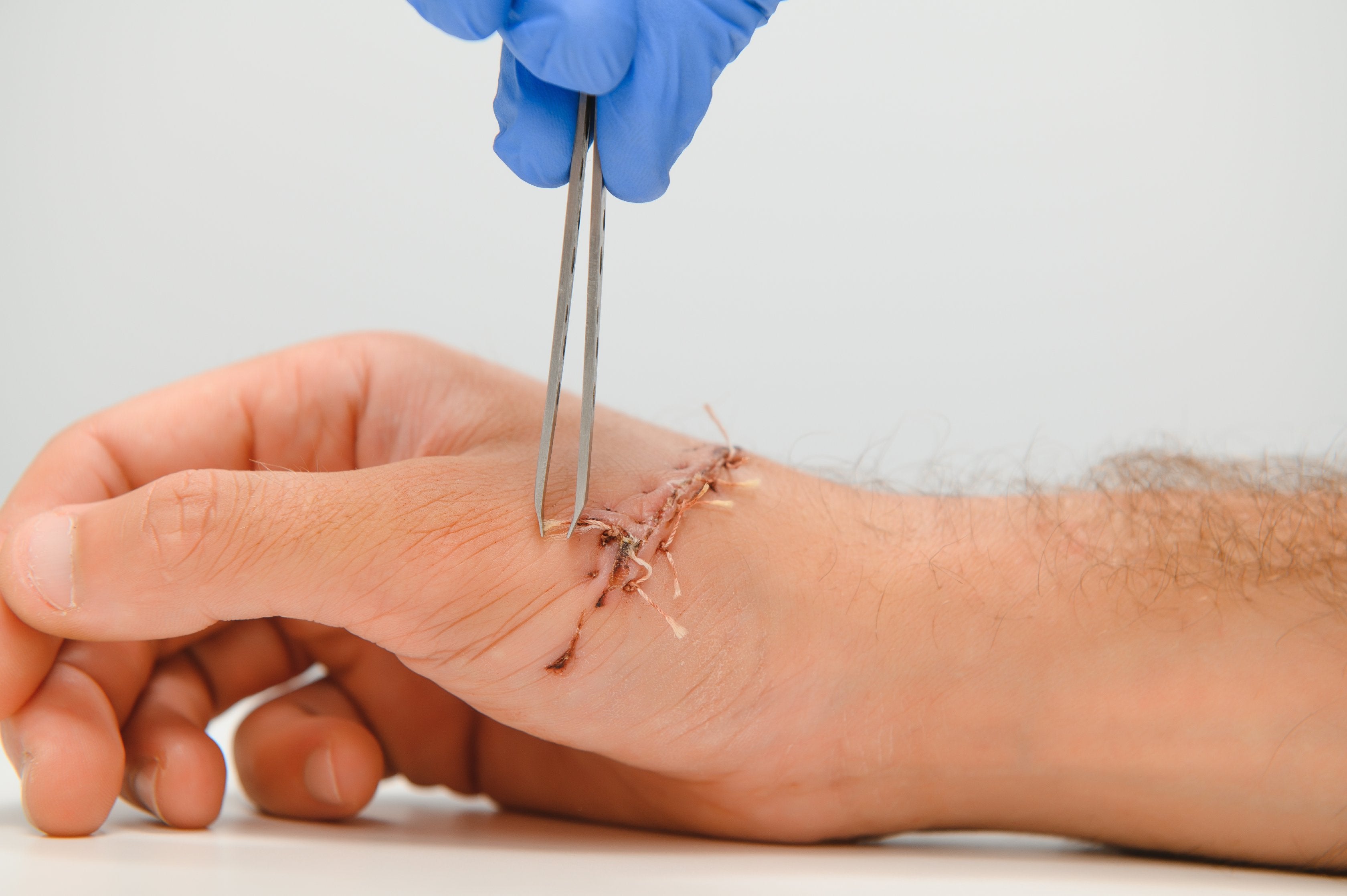 First aid treatment for splinters - ComplyPlus LMS™ - The Mandatory Training Group UK -