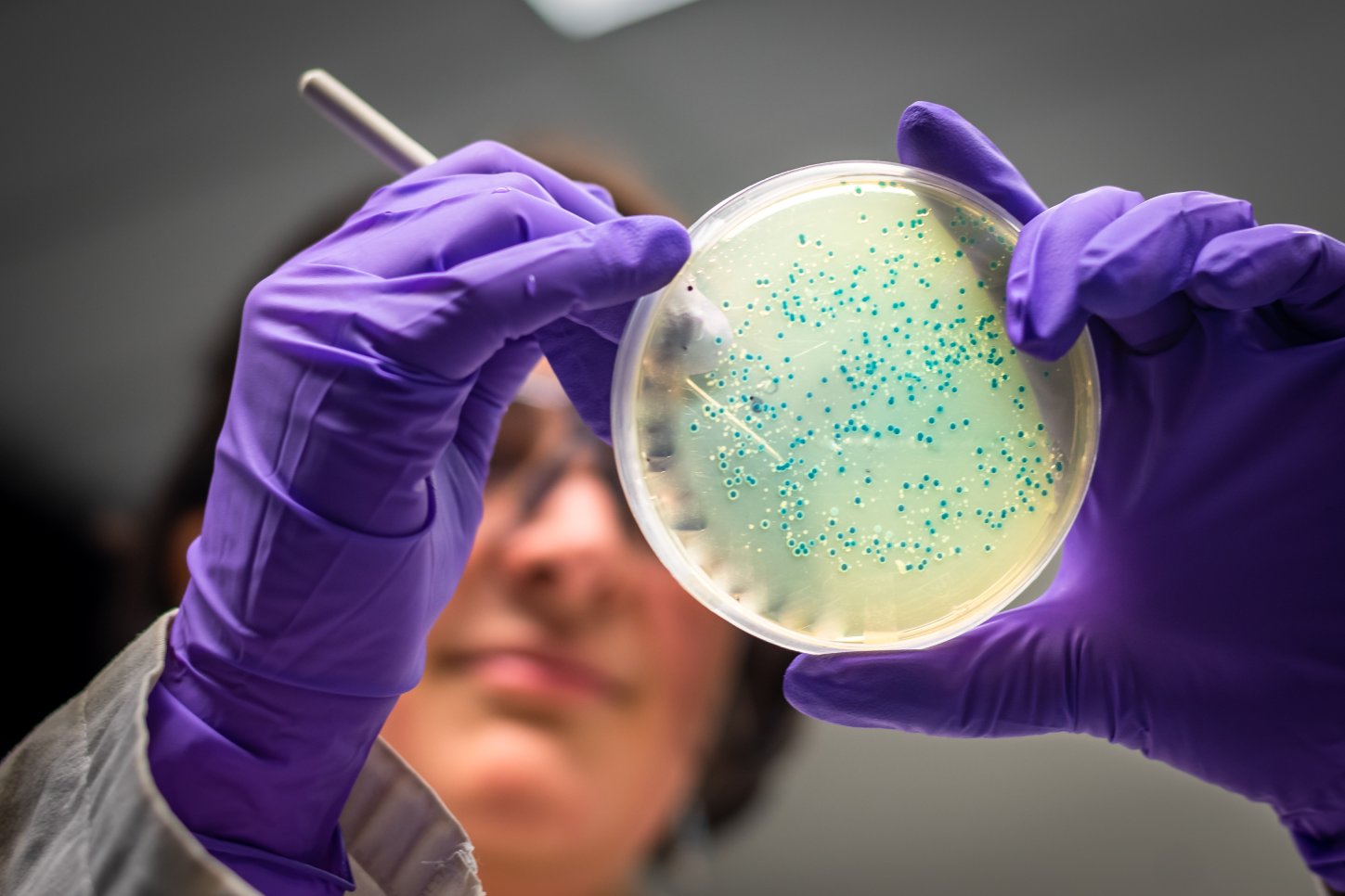 What is antimicrobial resistance?