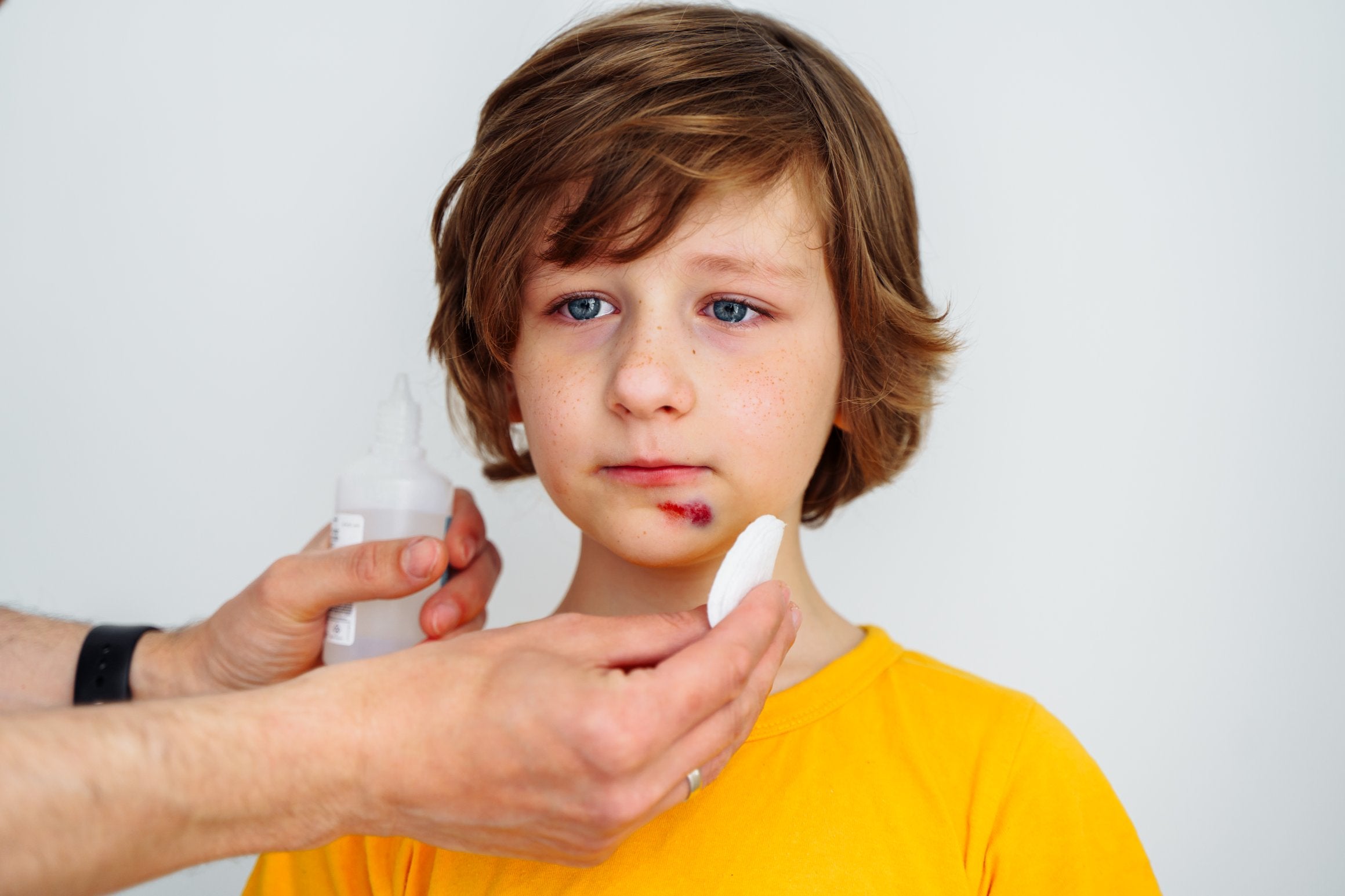 First aid treatment for bruises - ComplyPlus LMS™ - The Mandatory Training Group UK -
