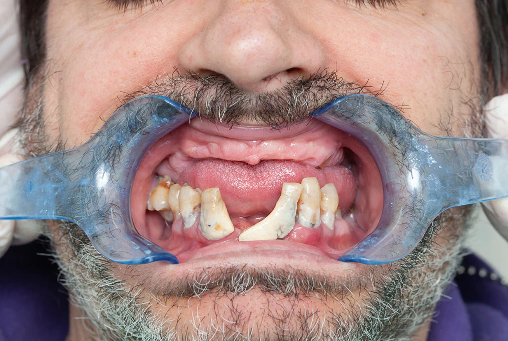 Mouth Cancer Action Month 2025 - The Mandatory Training Group UK -